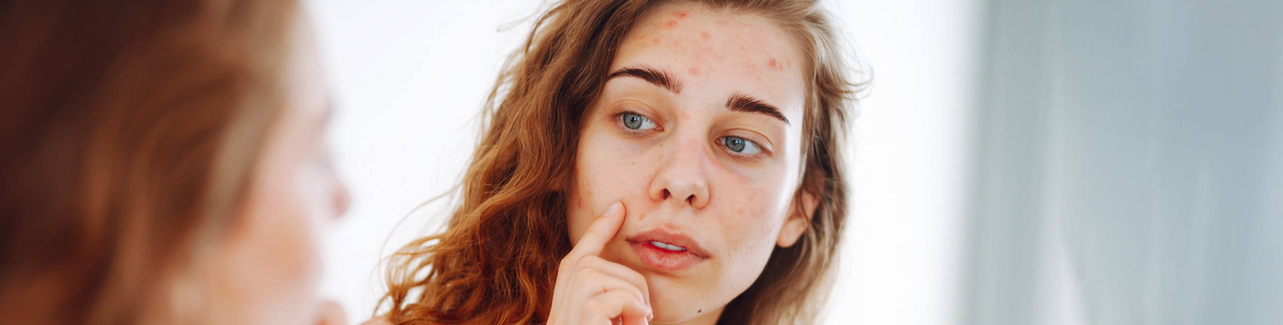 Млада жена със СПКЯ гледа лицето си, склонно към акне, в огледалото – Catafertyl