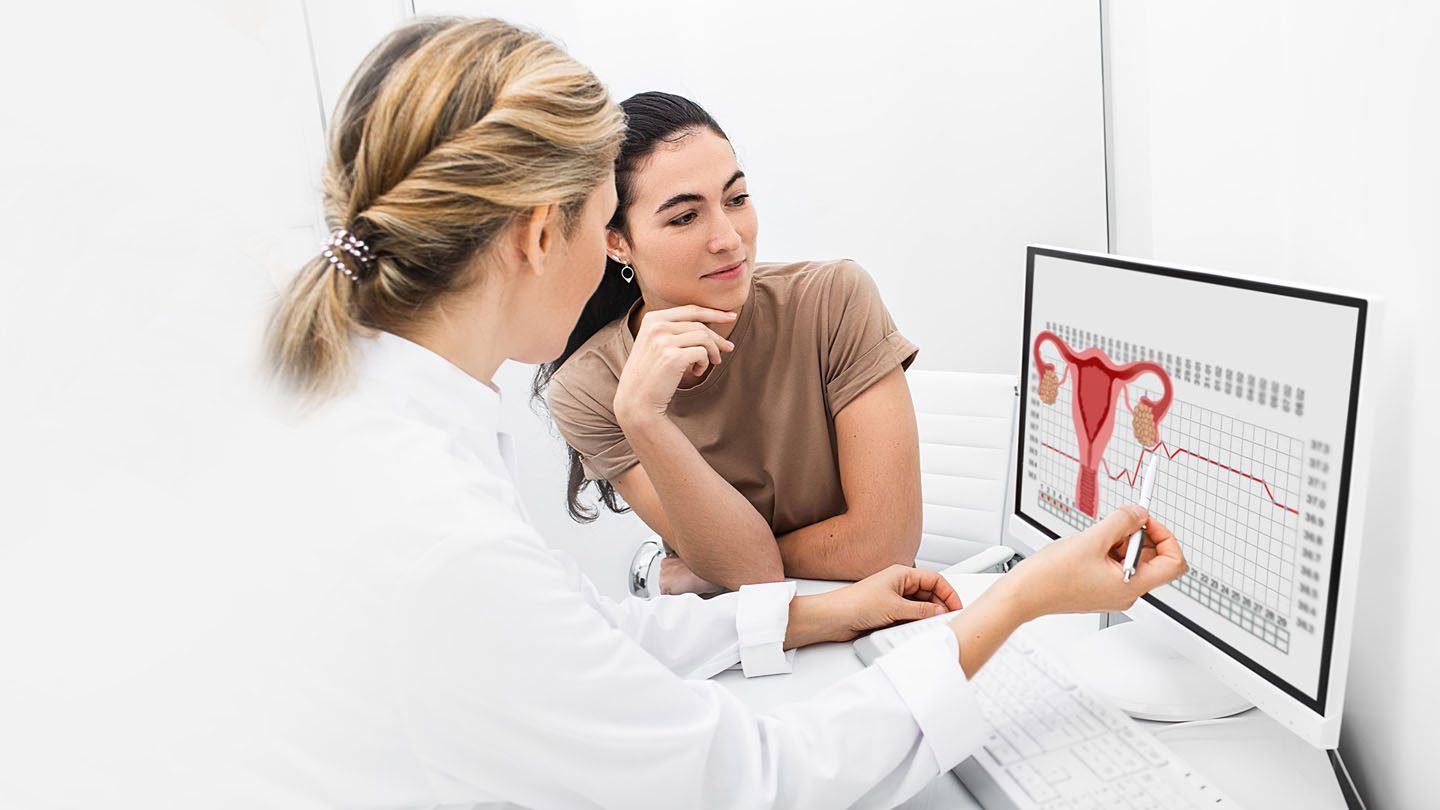 Синдромът на поликистозните яйчници (СПКЯ)